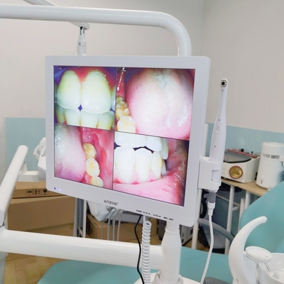와이파이 온인원 오럴 카메라와 대음파 LCD 화면 치과 오럴 카메라 스캐너