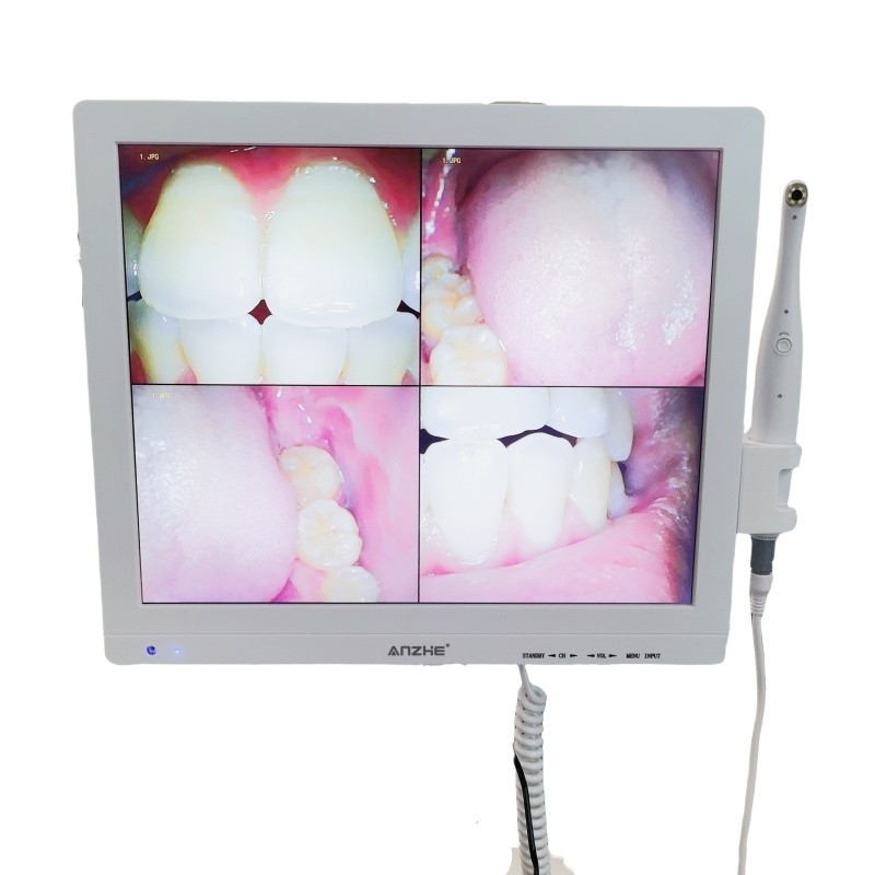 와이파이 온인원 오럴 카메라와 대음파 LCD 화면 치과 오럴 카메라 스캐너