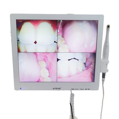 와이파이 온인원 오럴 카메라와 대음파 LCD 화면 치과 오럴 카메라 스캐너